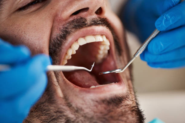 Best Emergency Dental Care for Broken or Chipped Teeth in Hammond, WI