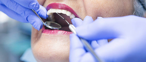 Best Emergency Wisdom Teeth Removal in Hammond, WI